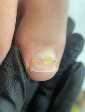 Carica l'immagine nel visualizzatore di Gallery, ◾️PROMO BLACK FRIDAY◾️ Prenotazione CORSO TITANIUM Podo BALANCE