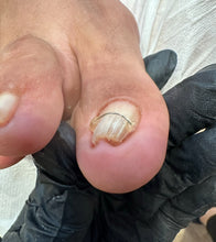 Carica l'immagine nel visualizzatore di Gallery, ◾️PROMO BLACK FRIDAY◾️ Prenotazione CORSO TITANIUM Podo BALANCE