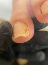 Carica l'immagine nel visualizzatore di Gallery, PRENOTAZIONE PEDICURE AVANZATO