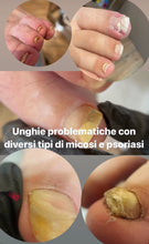 Carica l'immagine nel visualizzatore di Gallery, PRENOTAZIONE PEDICURE AVANZATO