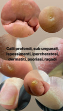 Carica l'immagine nel visualizzatore di Gallery, PRENOTAZIONE PEDICURE AVANZATO