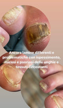 Carica l'immagine nel visualizzatore di Gallery, PRENOTAZIONE PEDICURE AVANZATO