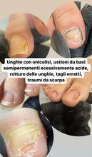 Carica l'immagine nel visualizzatore di Gallery, PRENOTAZIONE PEDICURE AVANZATO